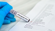 Румъния потвърди първи случай на вируса чикунгуня след пътуване до Африка